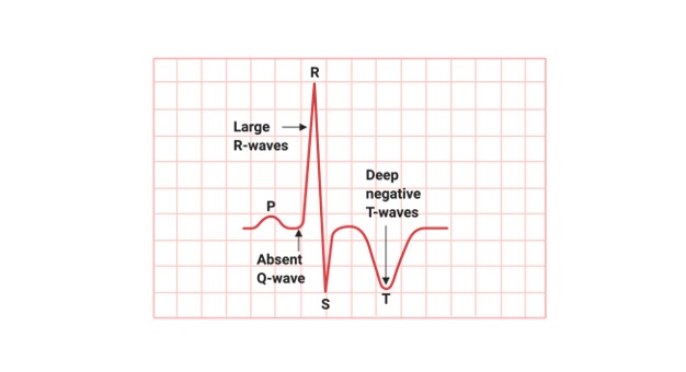 Cardiac cycle, Cardiac cycle phases, Cardiac cycle diagram, what is Cardiac cycle, Cardiac cycle definition