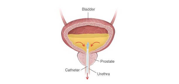 Urinary Bladder